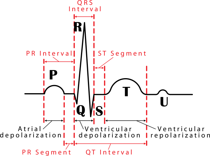 Electrocardiogram