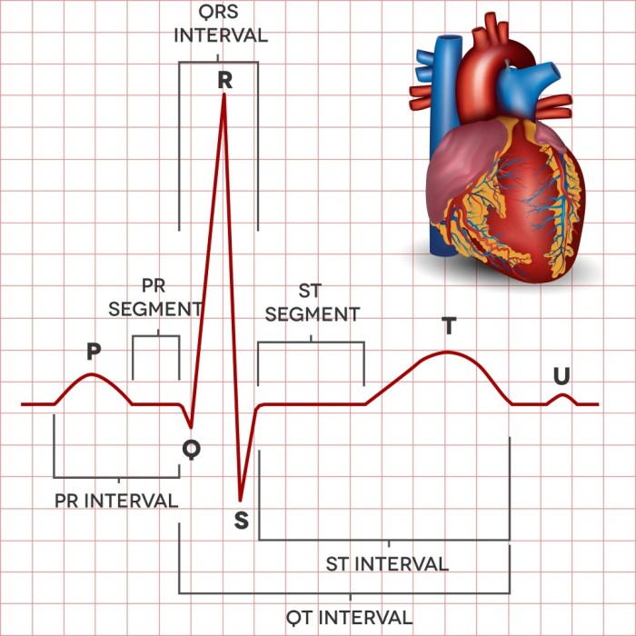 Match the component of the electrocardiogram to the correct definition.